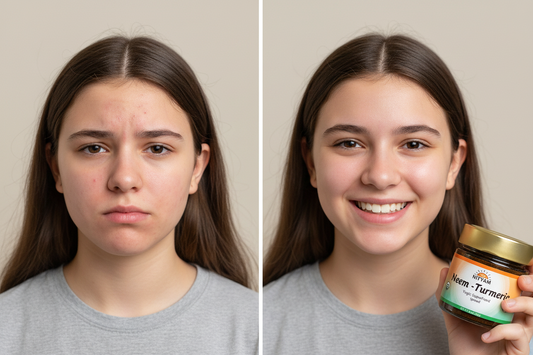 Neem Turmeric Herbal Spread